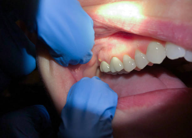 Best Walk-In Emergency Dentist in Woodside, PA